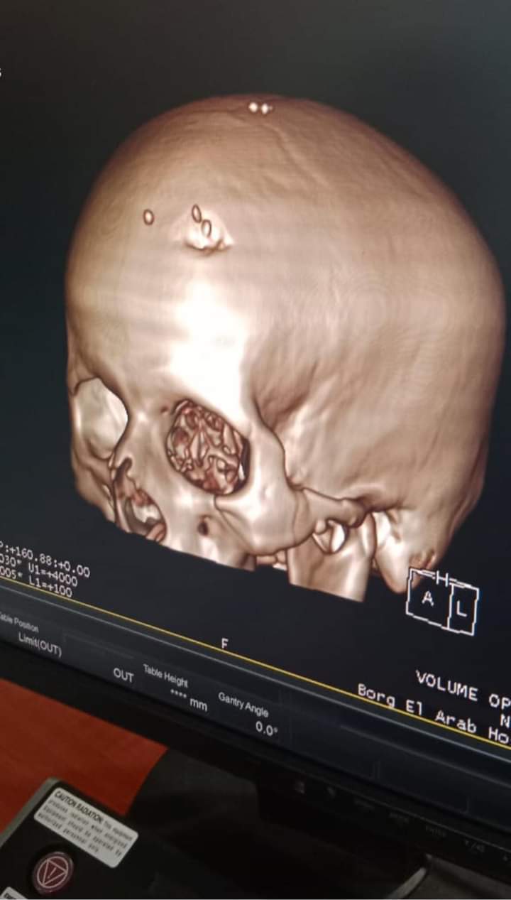 FB_IMG_1695086918664