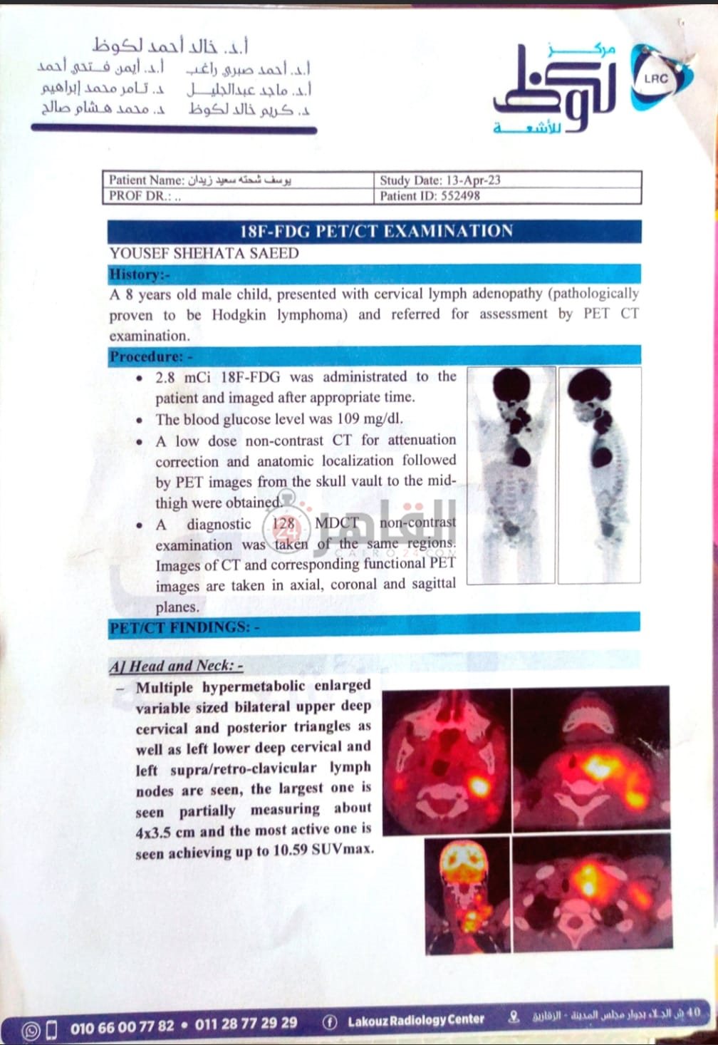 الأشعة الخاصة بـ يوسف 01