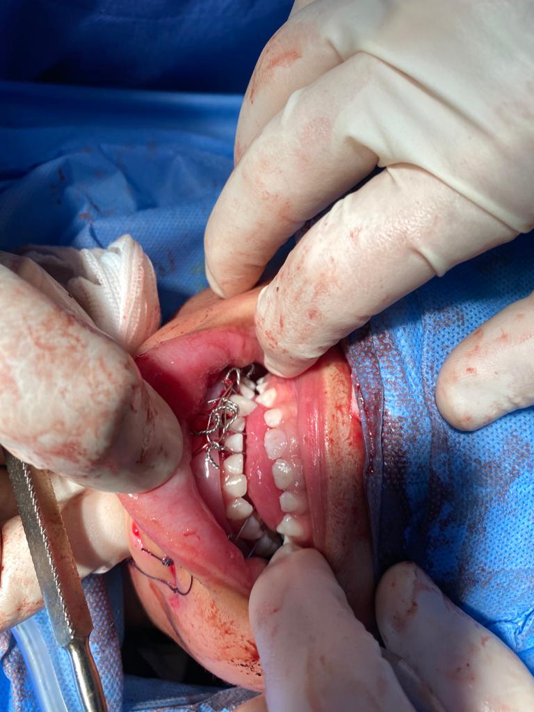 العملية الجراحية