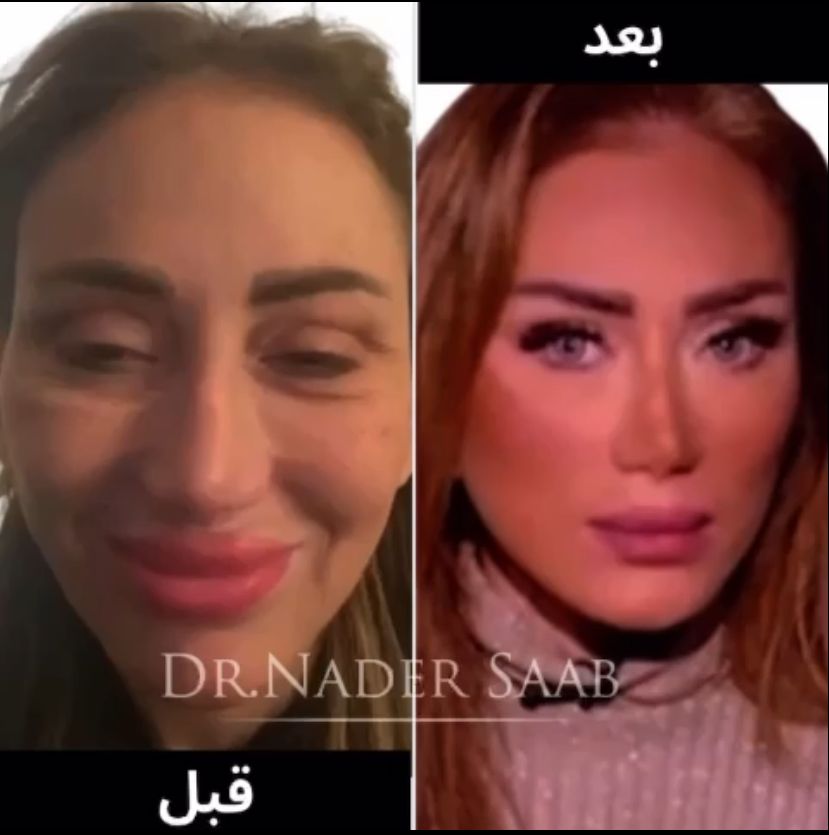 ريهام سعيد 20244