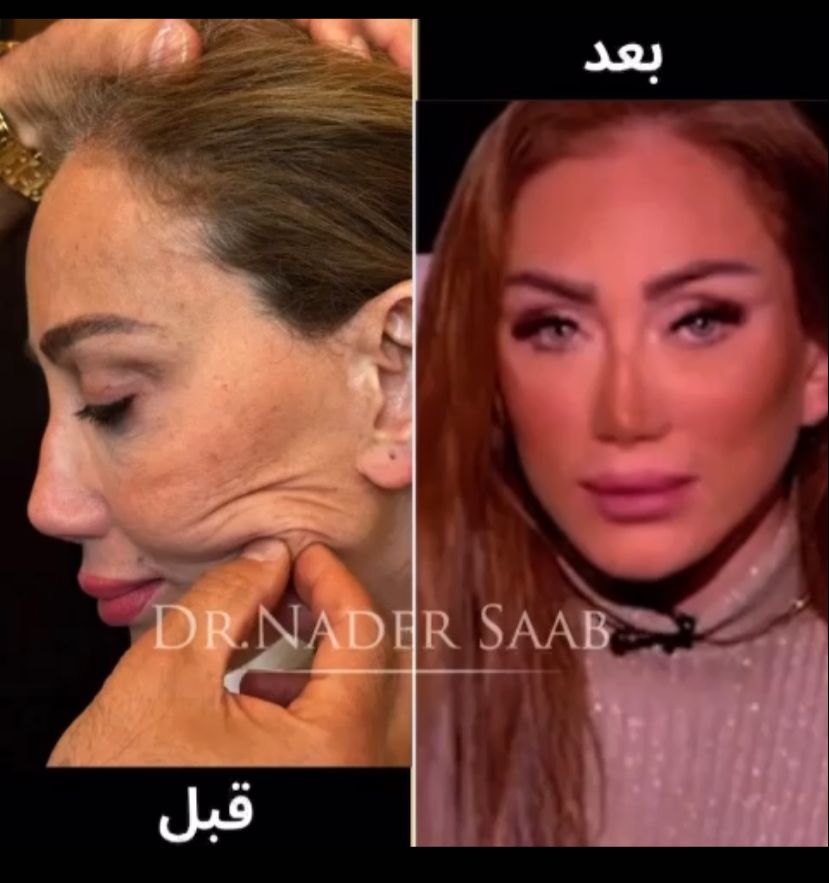 ريهام سعيد بعد العملية 