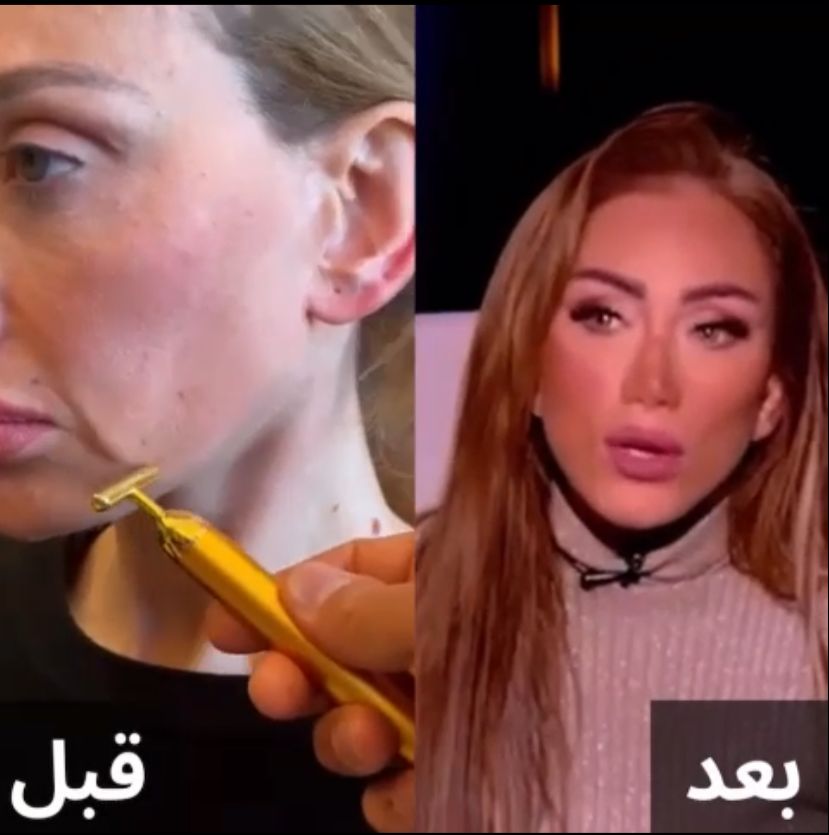 ريهام سعيد بعد العمليه