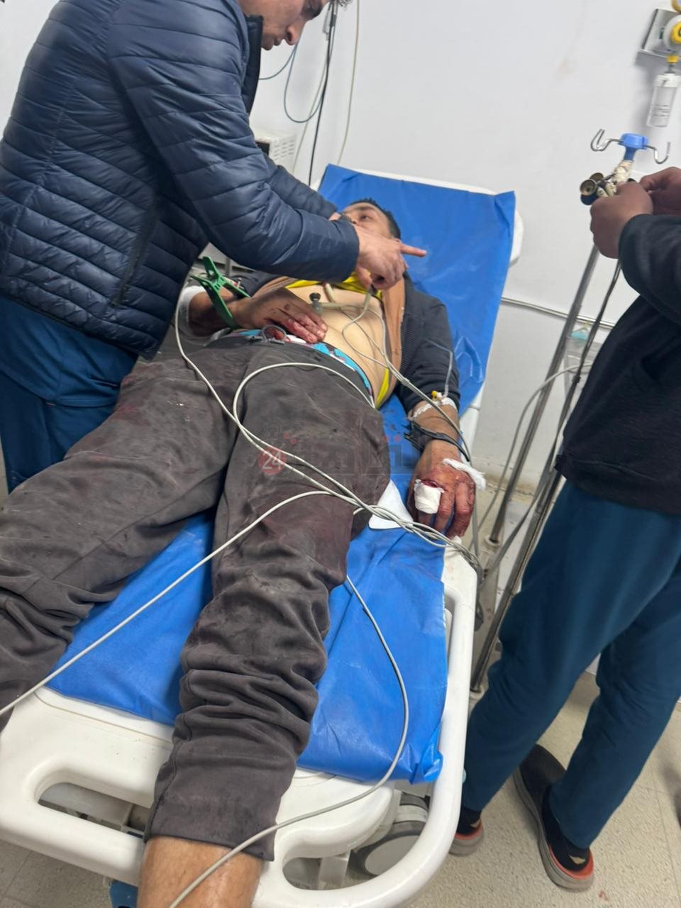 إصابة شخص بجروح قطعية في مشاجرة بالفيوم