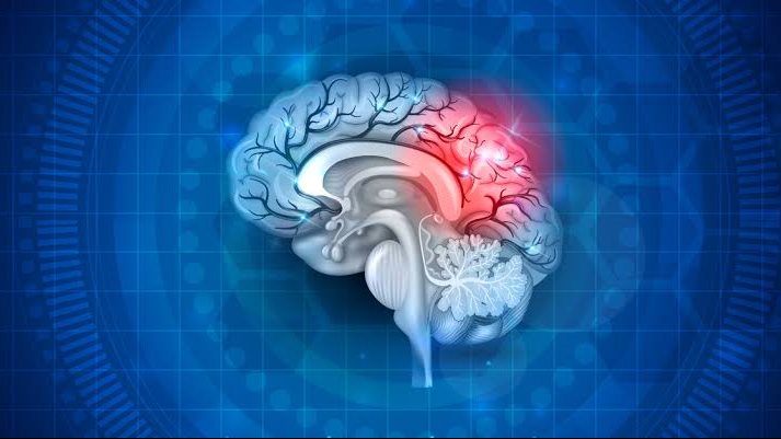 أضرار عدم وصول الدم للمخ