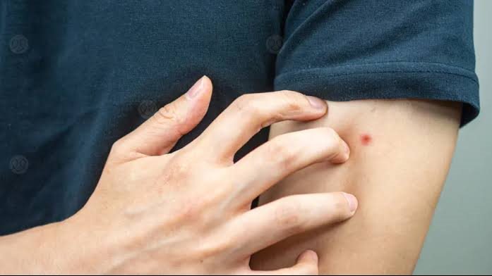 طرق طبيعية للتخلص من الحشرات المنزلية في الصيف