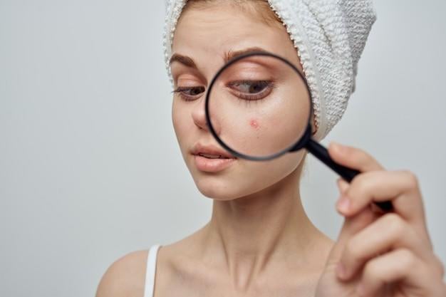 أفضل كريم طبيعي لعلاج حب الشباب في المنزل