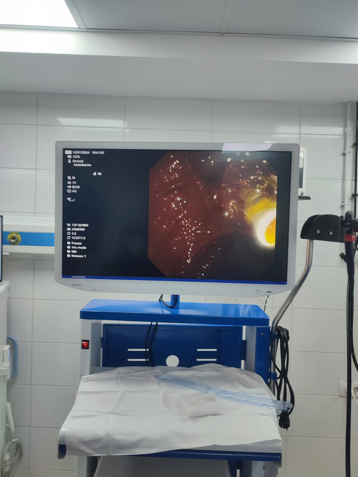 التشغيل التجريبي لعناية نزيف الجهاز الهضمي بالشرقية 03