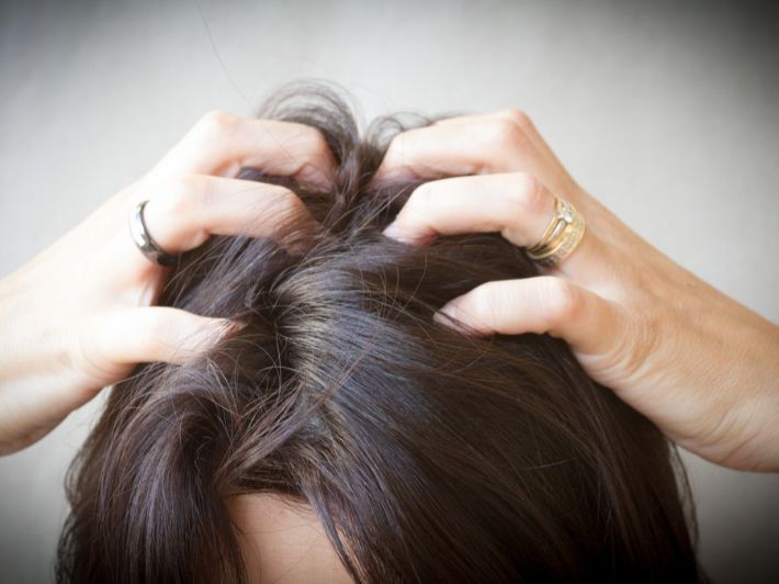 تفسير حلم رؤية القمل في شعر شخص آخر