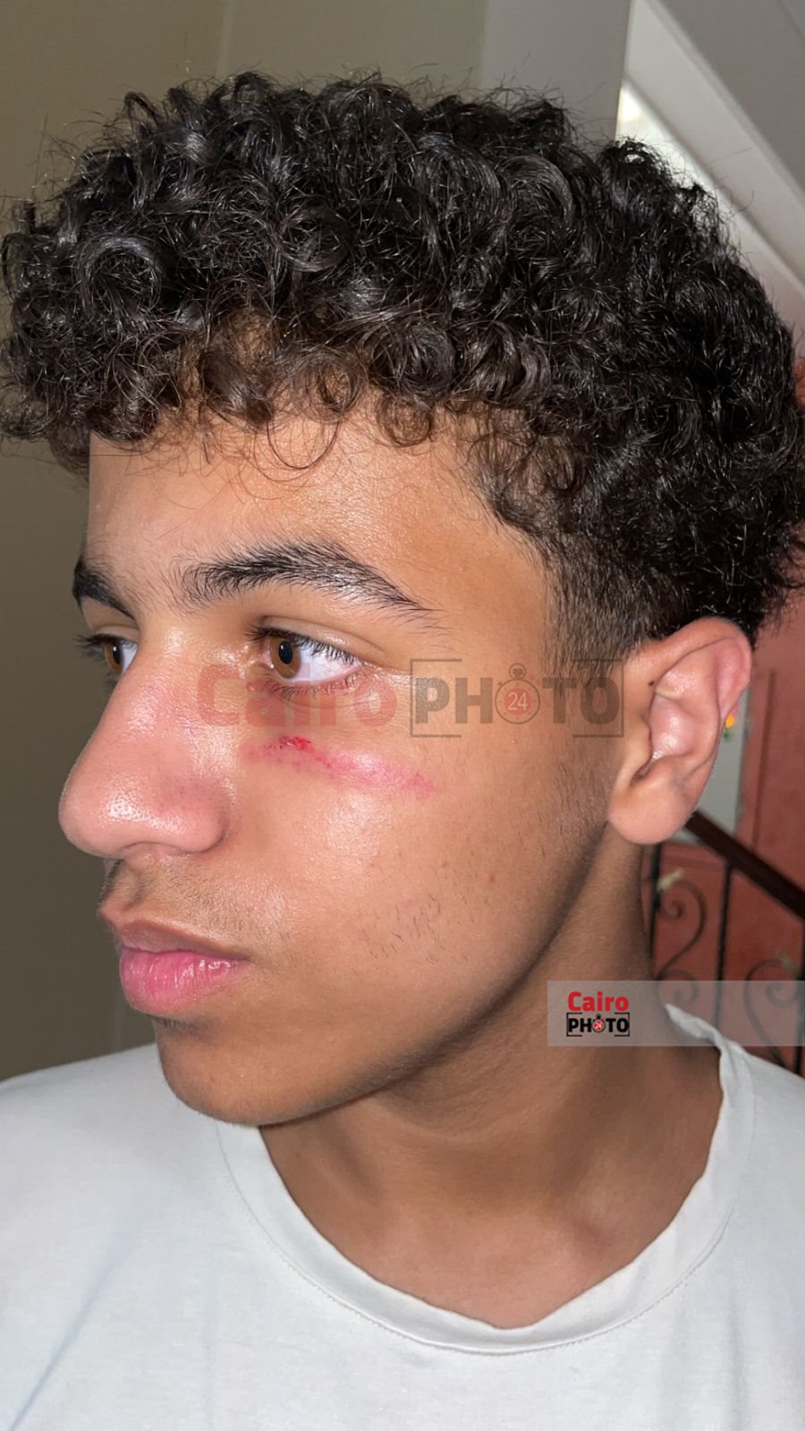 الطالب المصاب