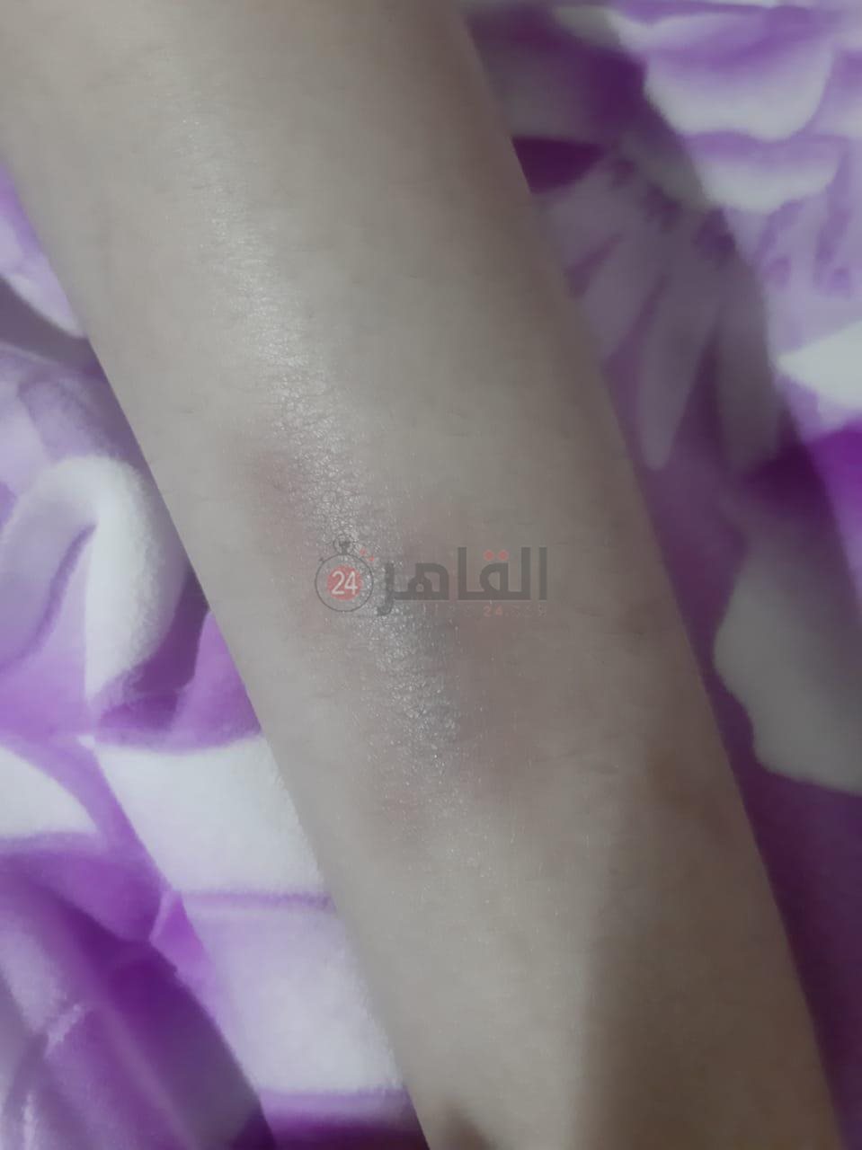 تقرير عرض التلميذ علي المستشفي 