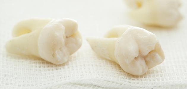 تفسير حلم سقوط الأسنان في اليد بدون ألم ودم