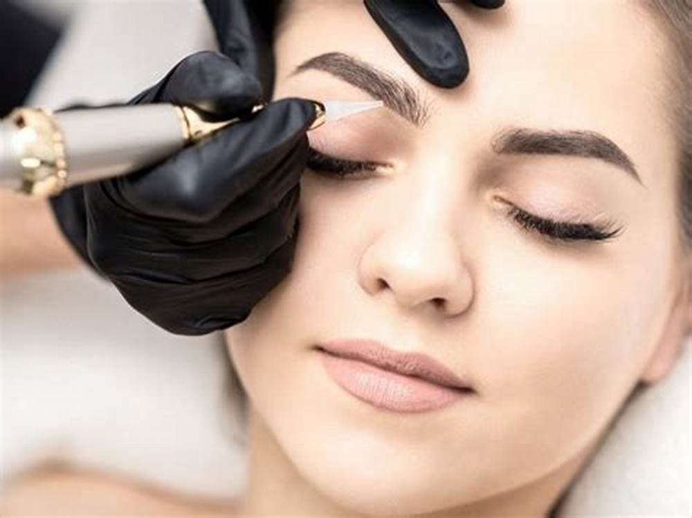 إزالة تاتو الحواجب&nbsp;