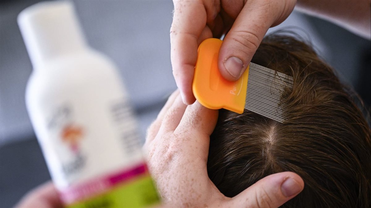 تفسير حلم رؤية القمل في شعر شخص آخر