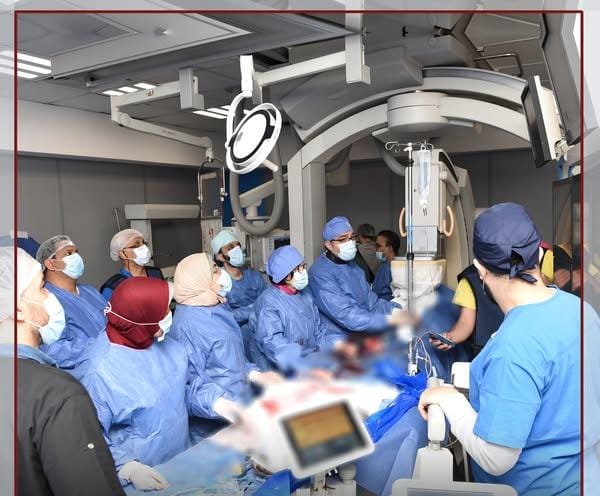 نجاح طبي بمستشفيات جامعة عين شمس 