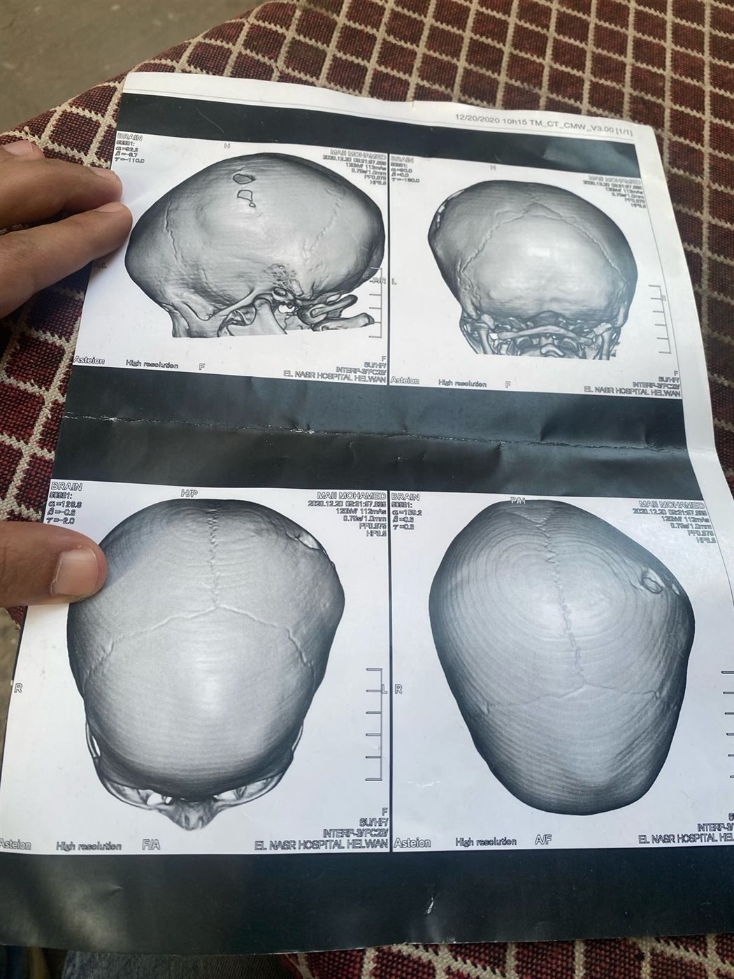 أشاعات خاصة بحالة الطفل