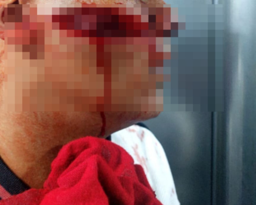 المجني عليه بعد الحادث