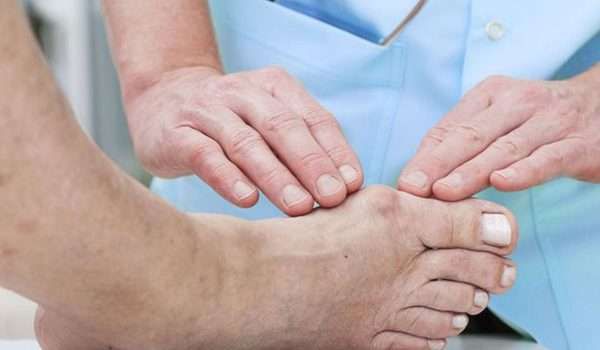 علاج النقرس بالأعشاب الطبيعية