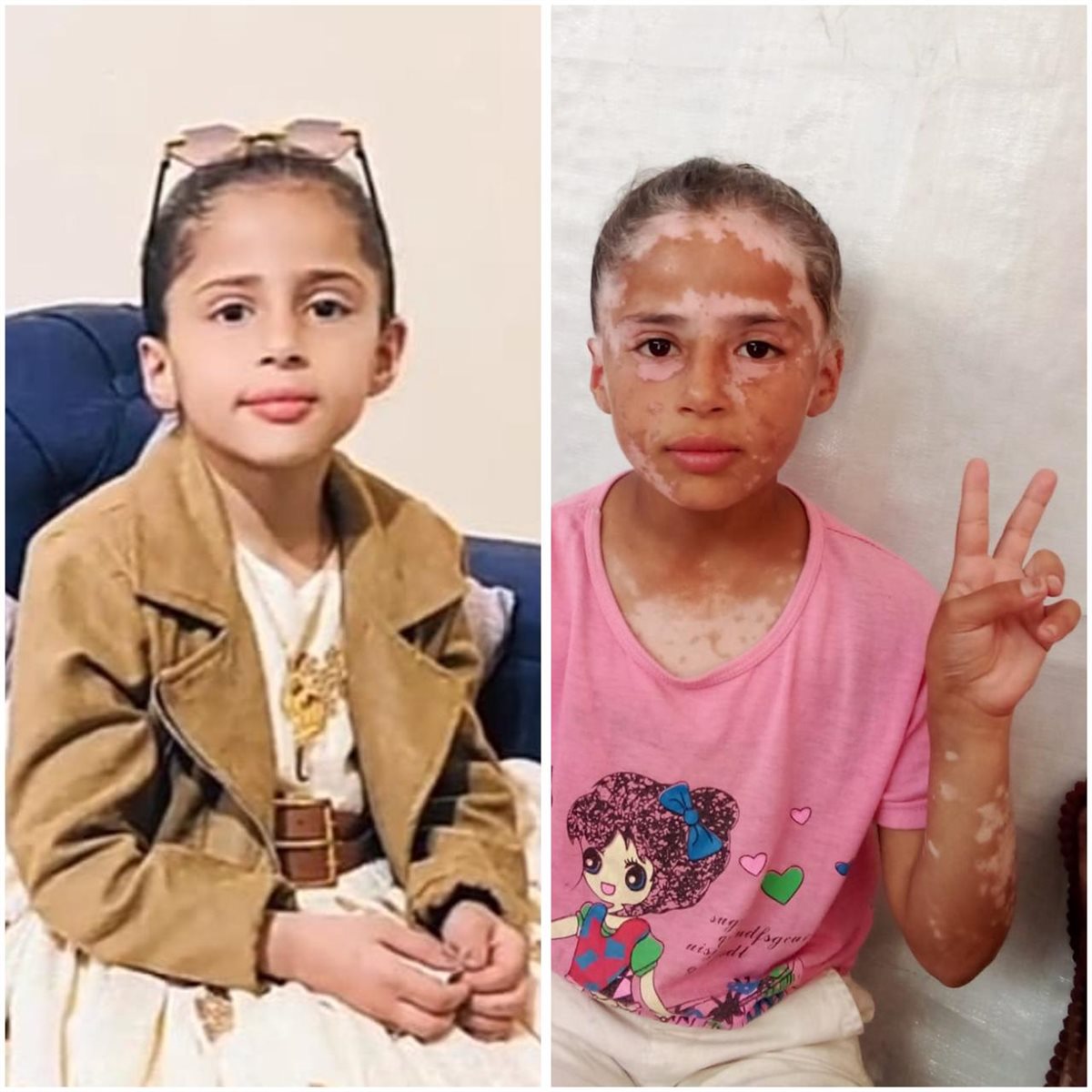 لانا الشريف قبل وبعد الحرب