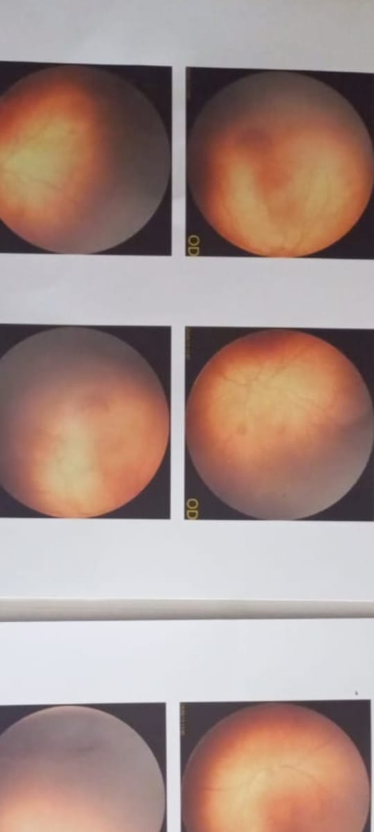 جانب من العملية 