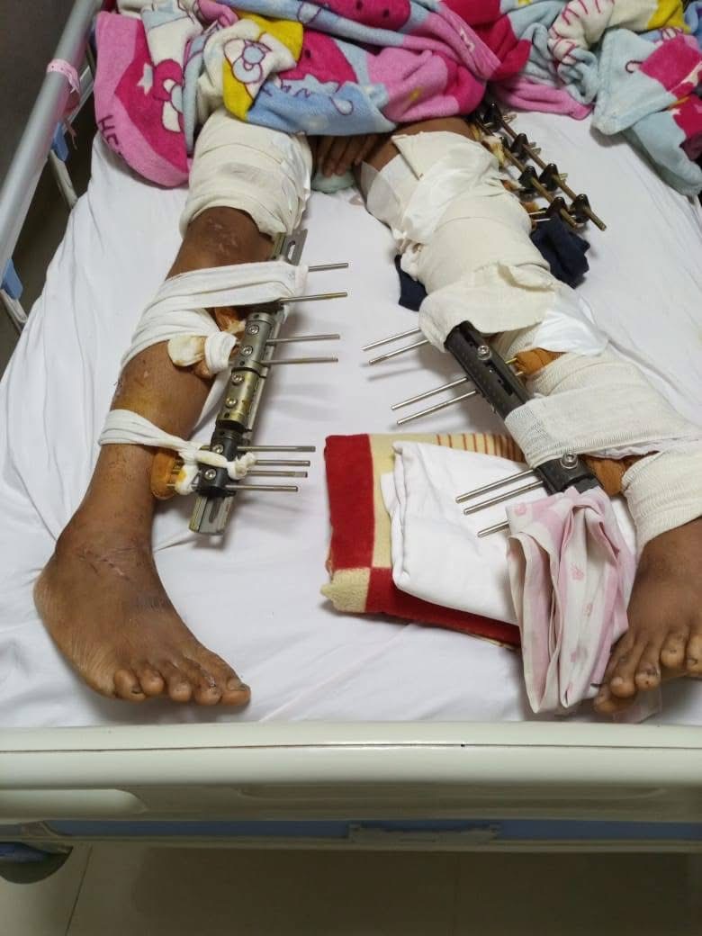 حالة الطالب في المستشفى