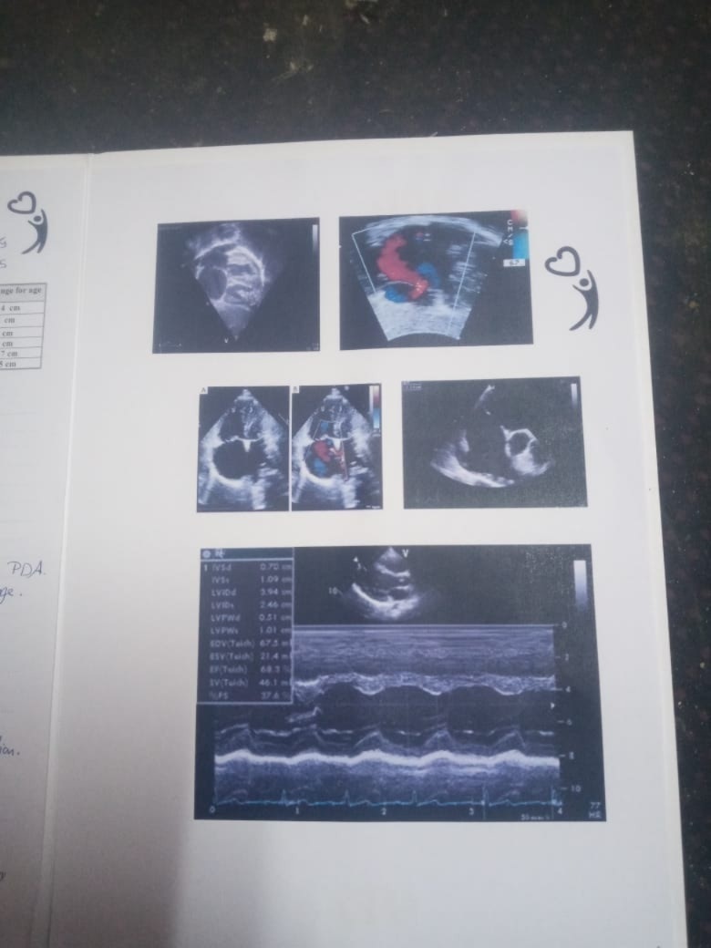 تقارير آدم6