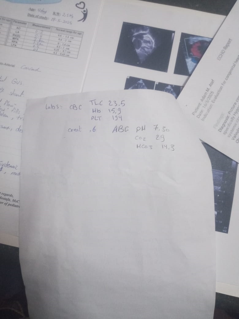 تقارير آدم 2