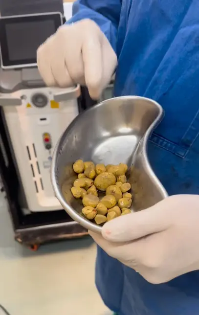 طبيب يحذر من تناول المشروبات الغازية بصورة يومية