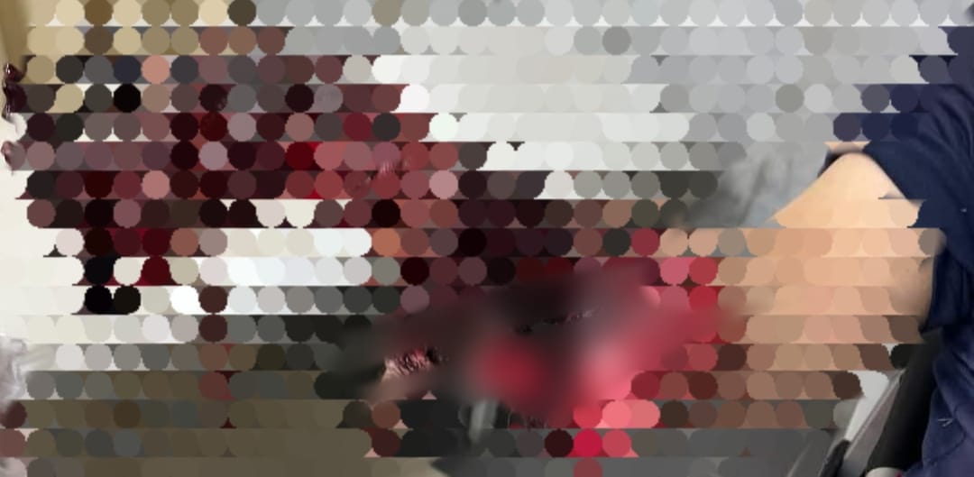 جانب من الجراحة