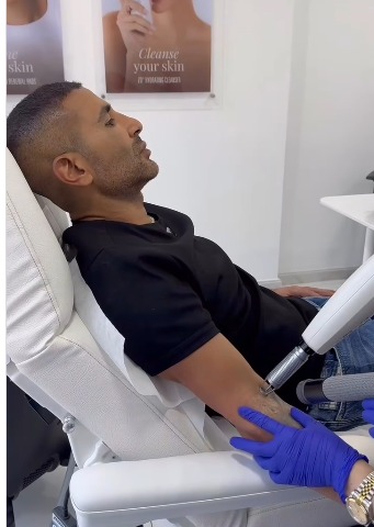أحمد سعد يبدأ مرحلة ازالة الوشم  ويُعلق: من أحسن القرارات اللي أخدتها