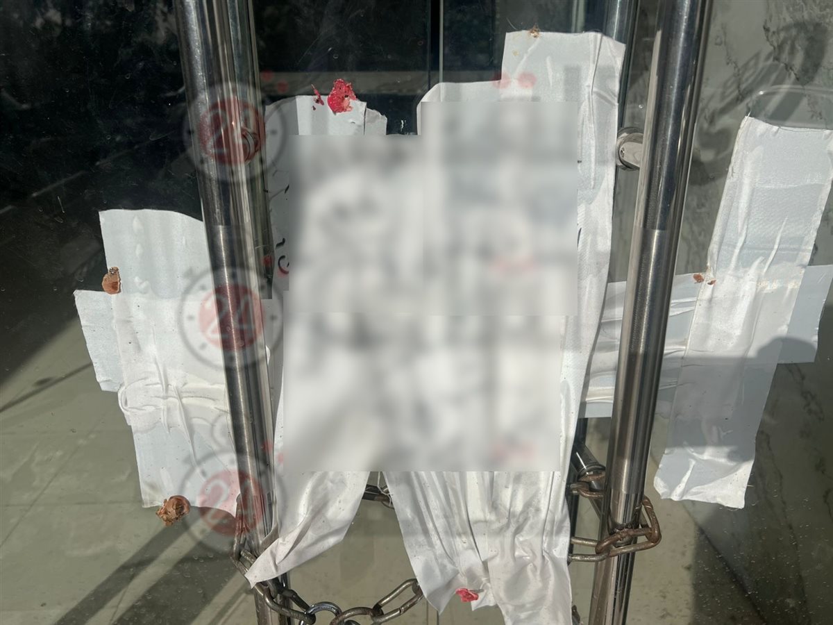 قرار الإغلاق والتشميع للمستشفى