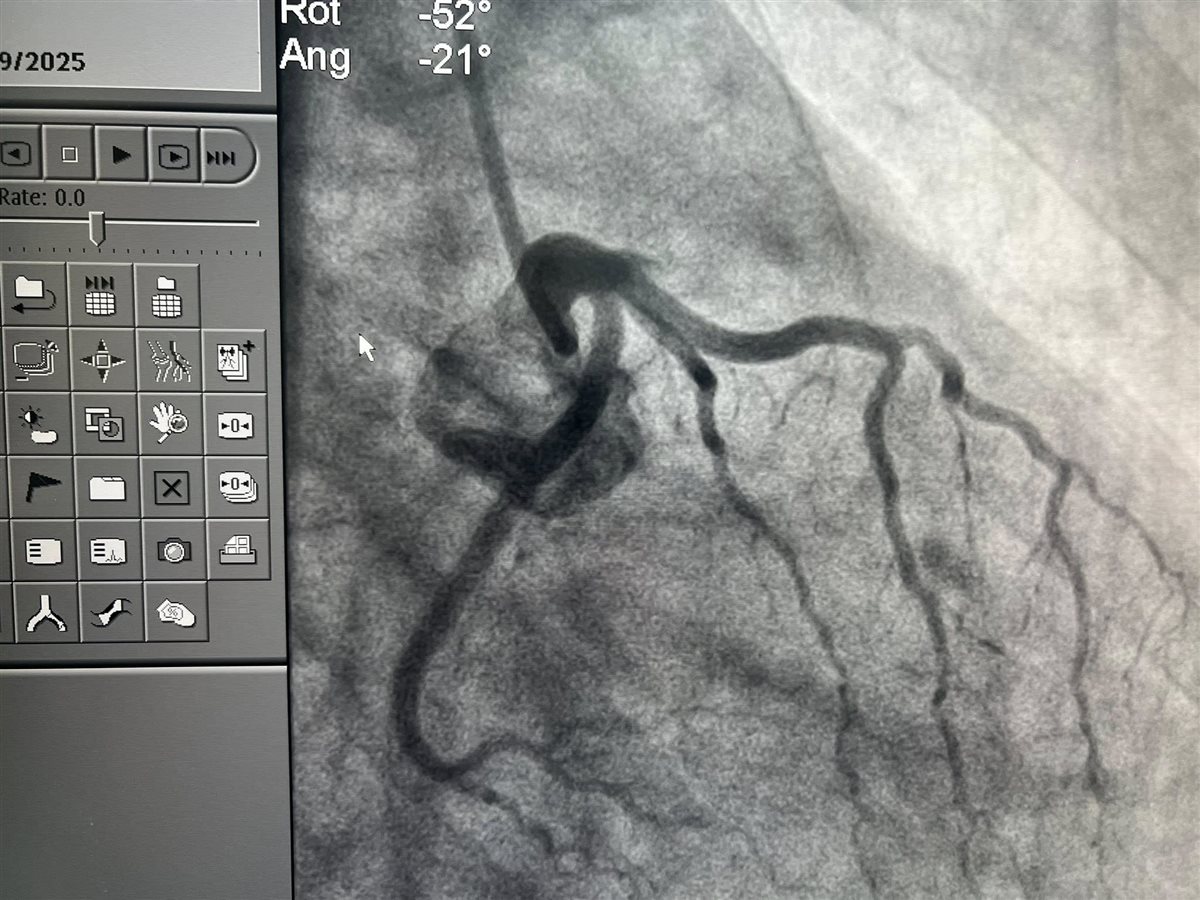 بعض من فحوصات حالات الشباب المصابة بسبب مخدر الحشيش