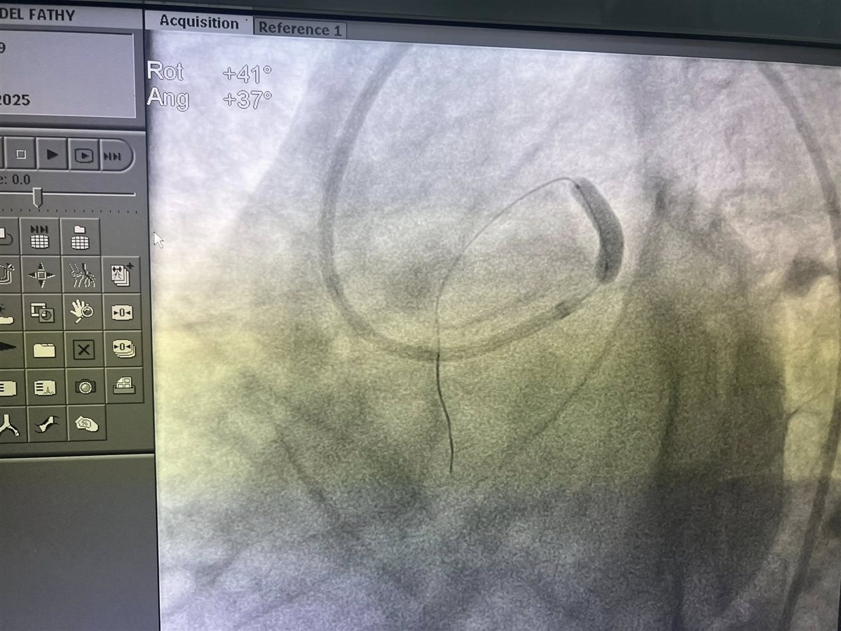 بعض من فحوصات حالات الشباب المصابة بسبب مخدر الحشيش