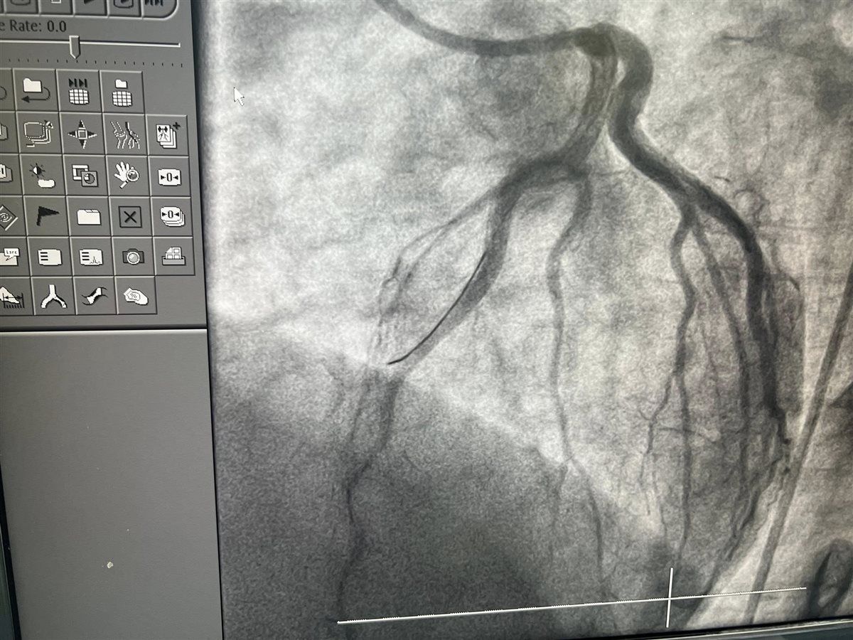 بعض من فحوصات حالات الشباب المصابة بسبب مخدر الحشيش