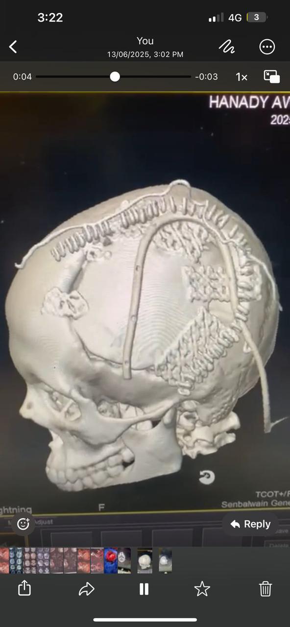 جانب من الجراحة 