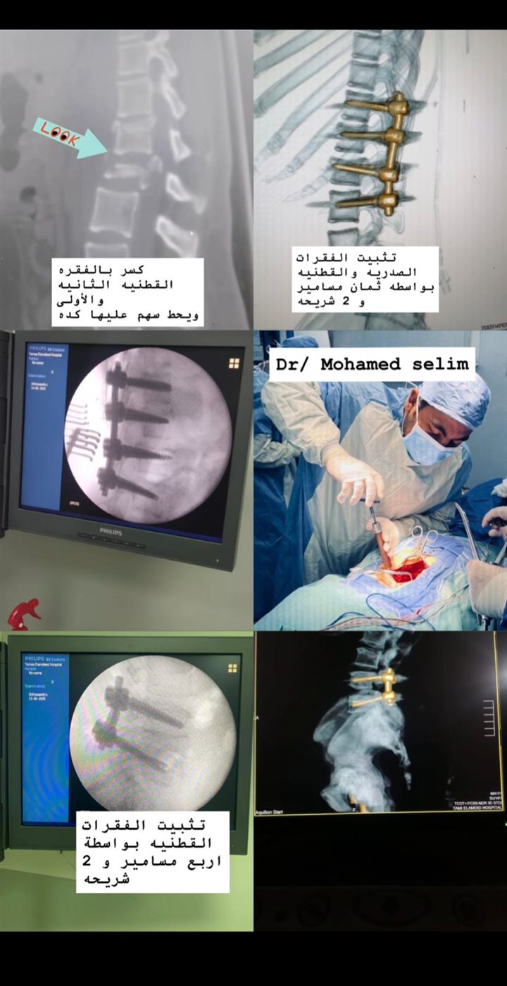 جانب من الجراحات 