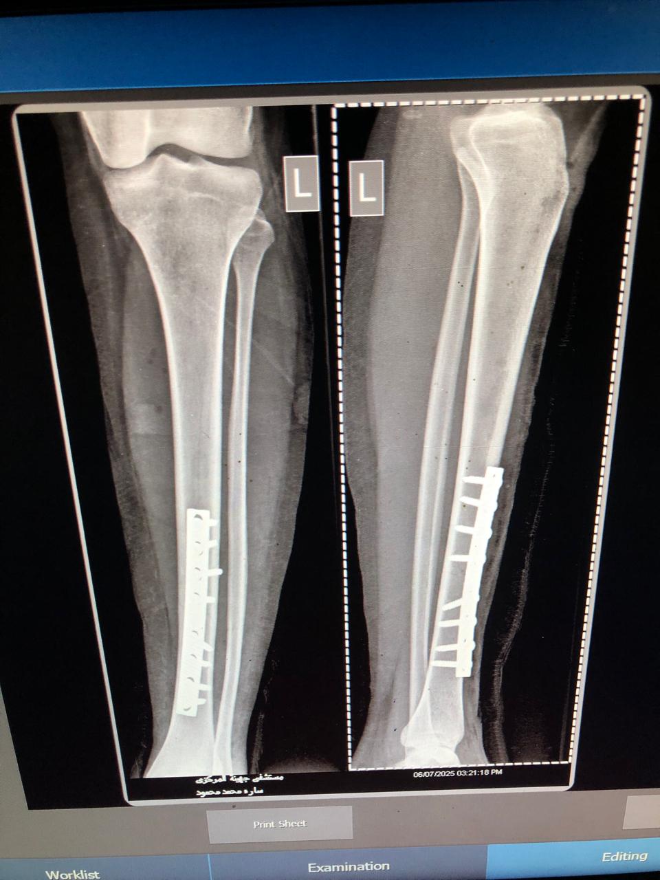 وكيل صحة سوهاج يوفد فريقًا طبيًا من المستشفى العام لمتابعة مصابي حادث جهينة