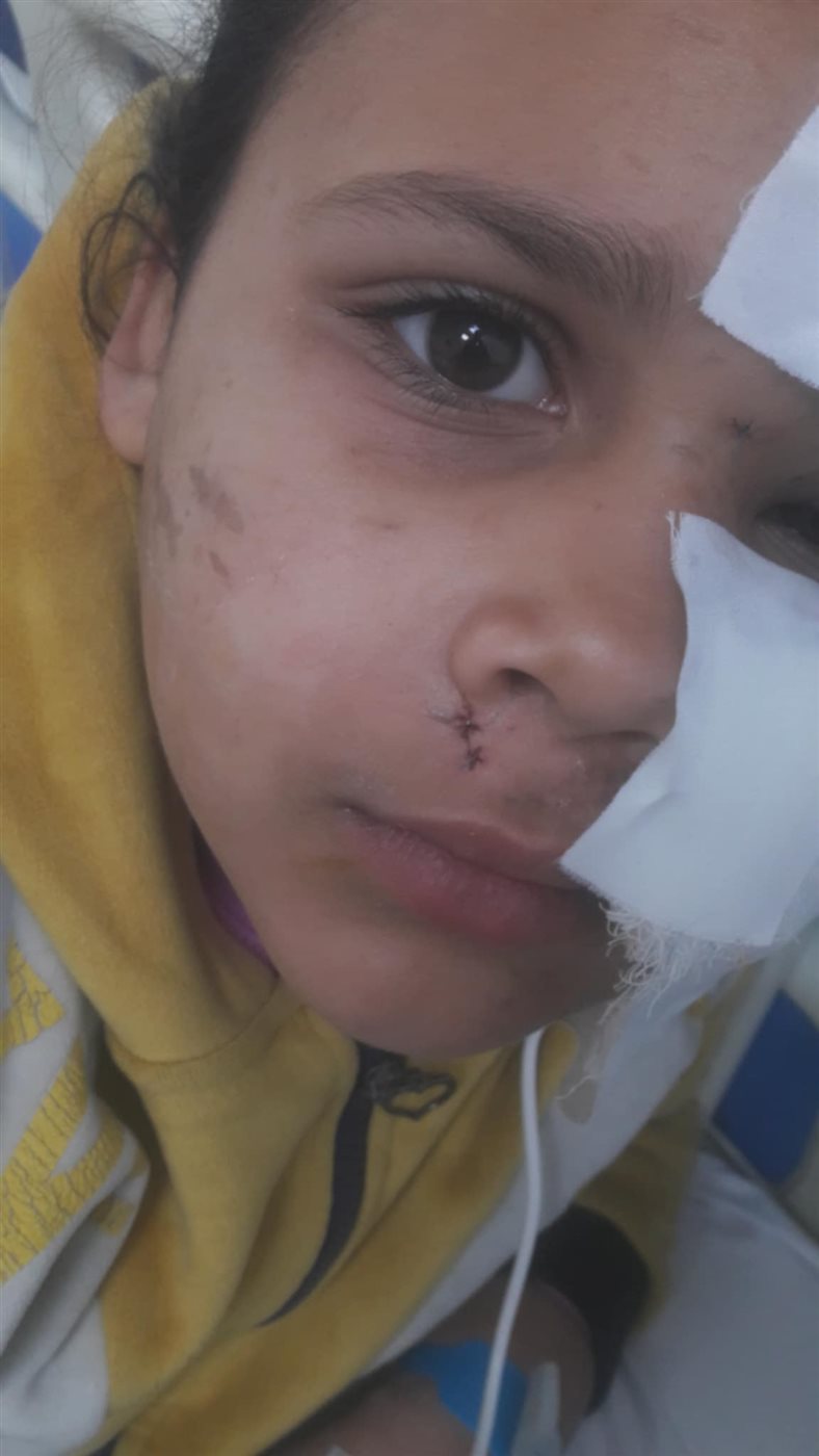 فلسطيني ناجٍ من مجزرة غزة يستغيث لتلقي العلاج