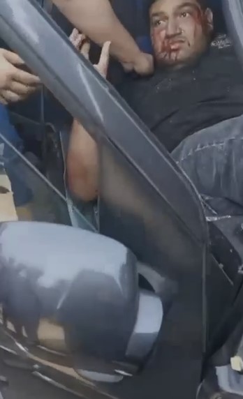 إصابة شخصين في حادث تصادم ملاكي بالتجمع 