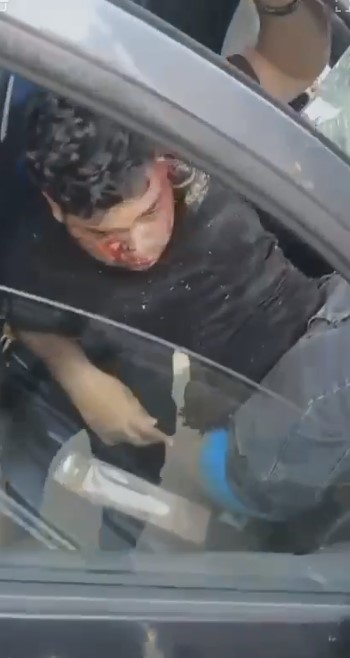 إصابة شخصين في حادث تصادم ملاكي بالتجمع 