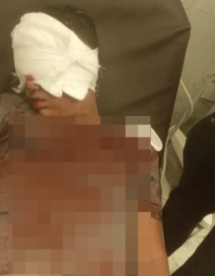 الصغير ضحية التنمر