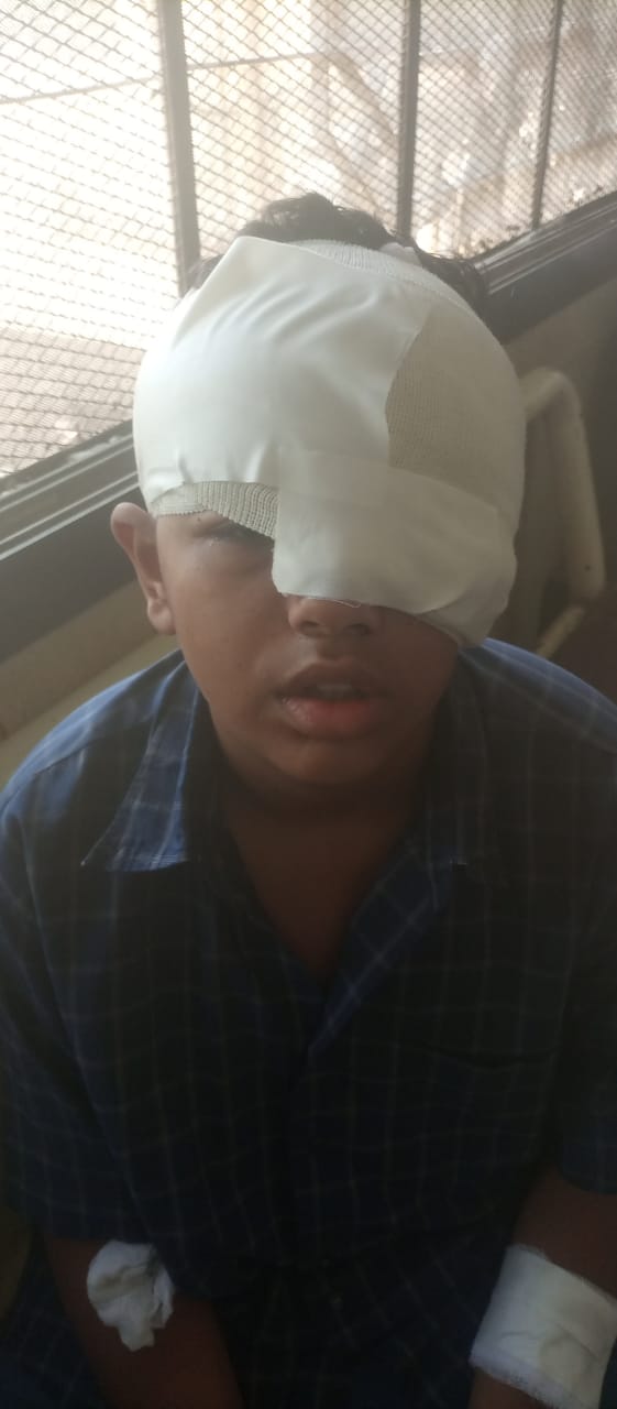 الصغير ضحية التنمر