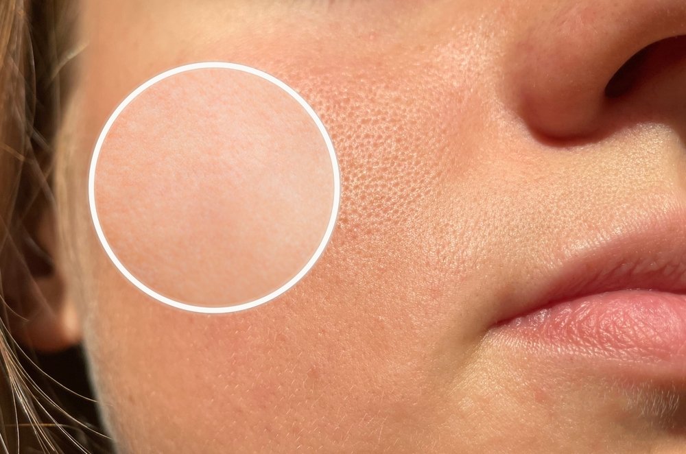 إزاي تعرف نوع بشرتك وطرق العناية اليومية بها بسهولة