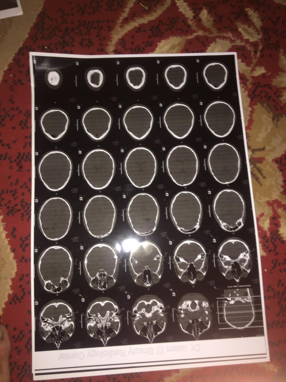 التقارير الطبية الخاصة بطه