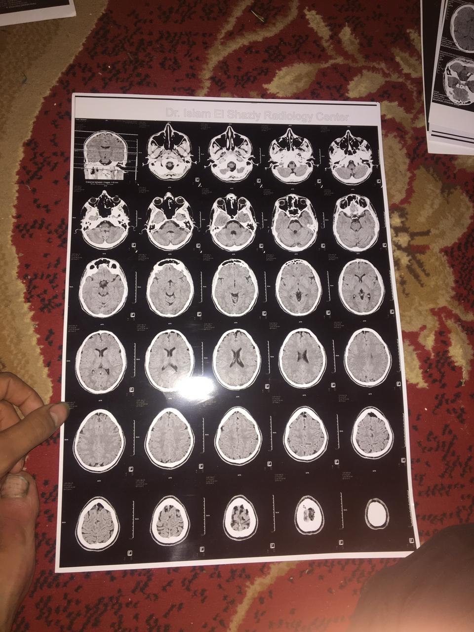 التقارير الطبية الخاصة بطه