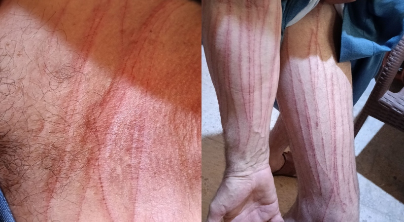 فتاة تتعرض للسحر الأسود على يد حماتها في الشرقية