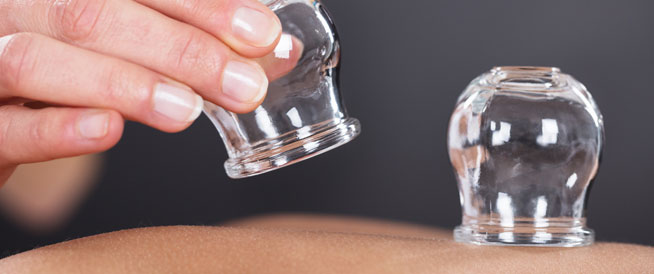 فوائد الحجامة الصحية