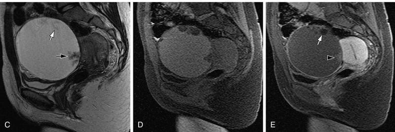 جاني من الجراحة 