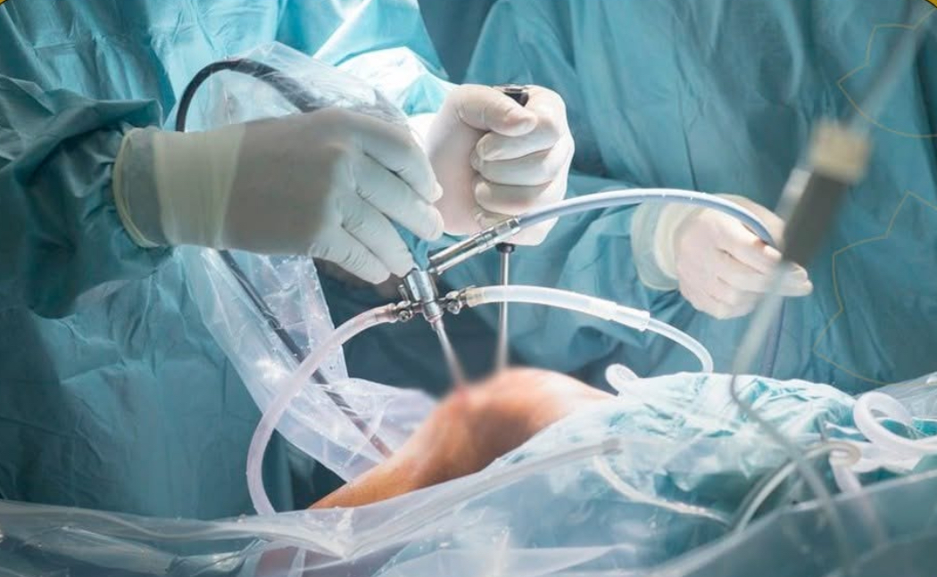 إنقاذ ركبة بعملية مزدوجة للرباط الصليبي