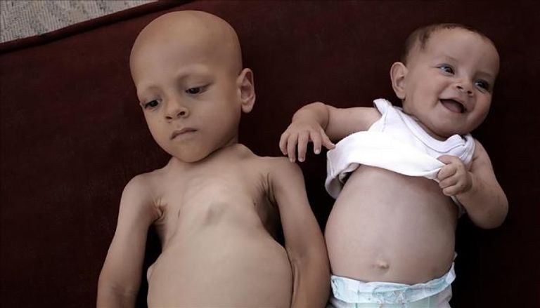  الطفل عبد الله أبو زرقة  وشقيقته حبيبة شقيقة