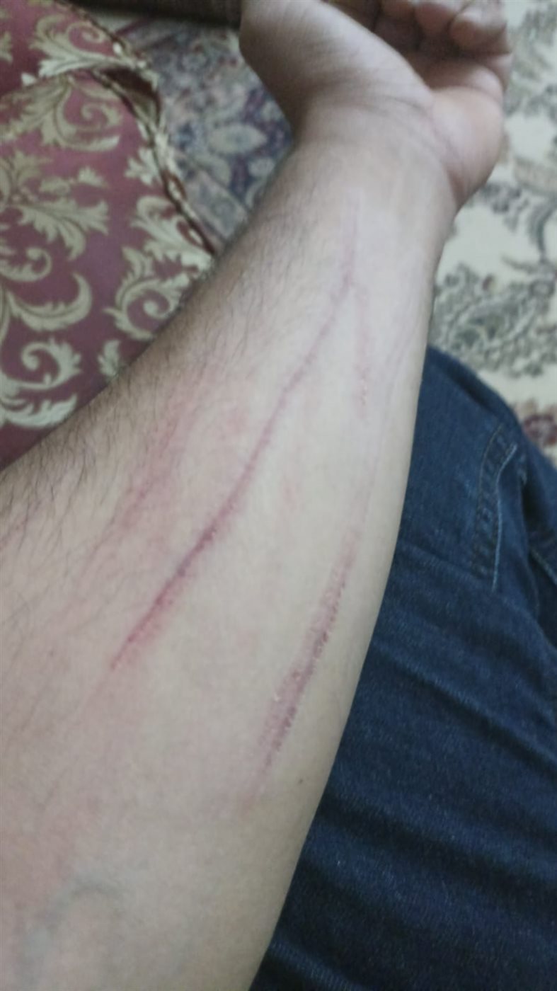 جانب من الواقعة